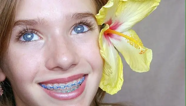 Ocean Dental Studio / San Juan del Sur Dental Clinic photo of girl smiling with braces and a yellow flower in her hair